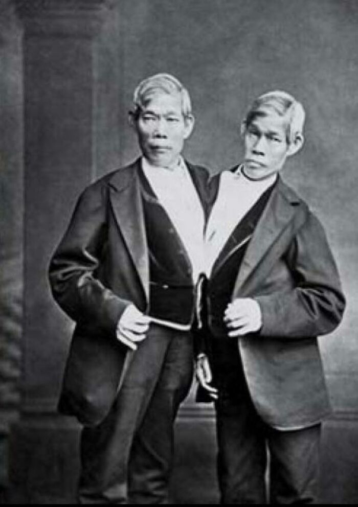 Fun Fact 145 Years Ago The Twins Chang And Eng Bunker Died On Jan. 17th. They Were Conjoined Twins. Born In Siam They Were The Name Giver For The Siamese Twins