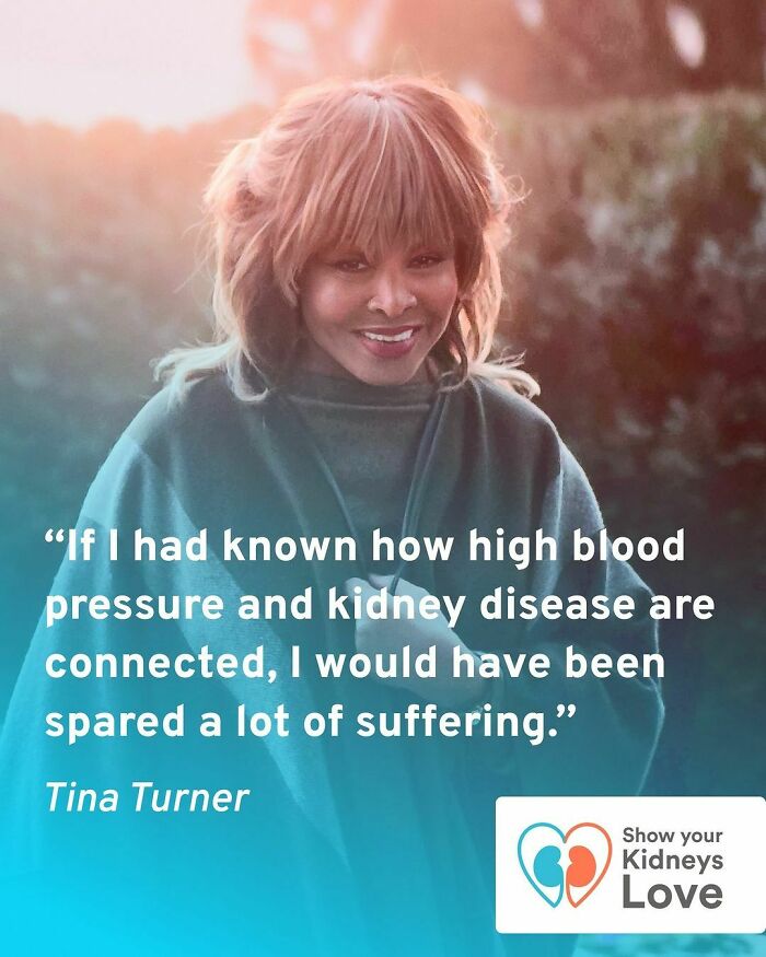 El ominoso post de Instagram de Tina Turner dos meses antes de morir explicaba mucho sobre su estado de salud