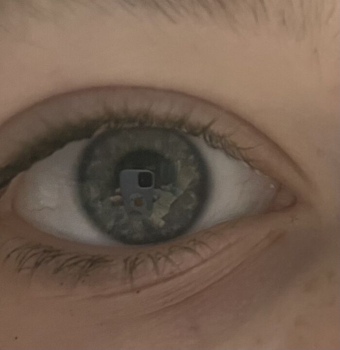 You Can See My Phone Case!