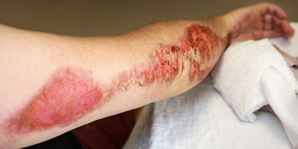 RoadRash-64592afe35ae2-png.jpg