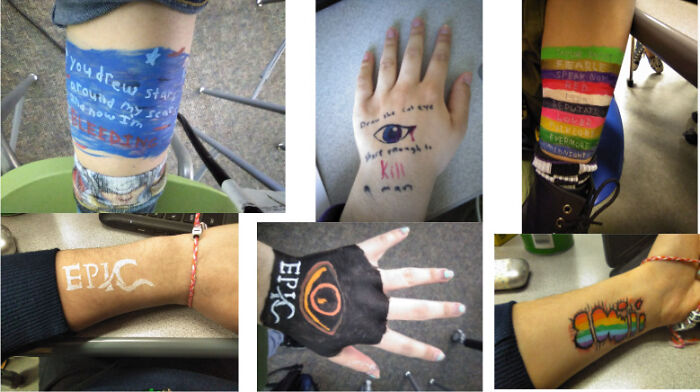 I Have A Few Lol. Some Of These Are On My Arms And Legs Not Just On My Hands But Whatever. I Had To Put Them Together In A Collage Since Bored Panda Wouldn't Let Me Upload More Than One Photo