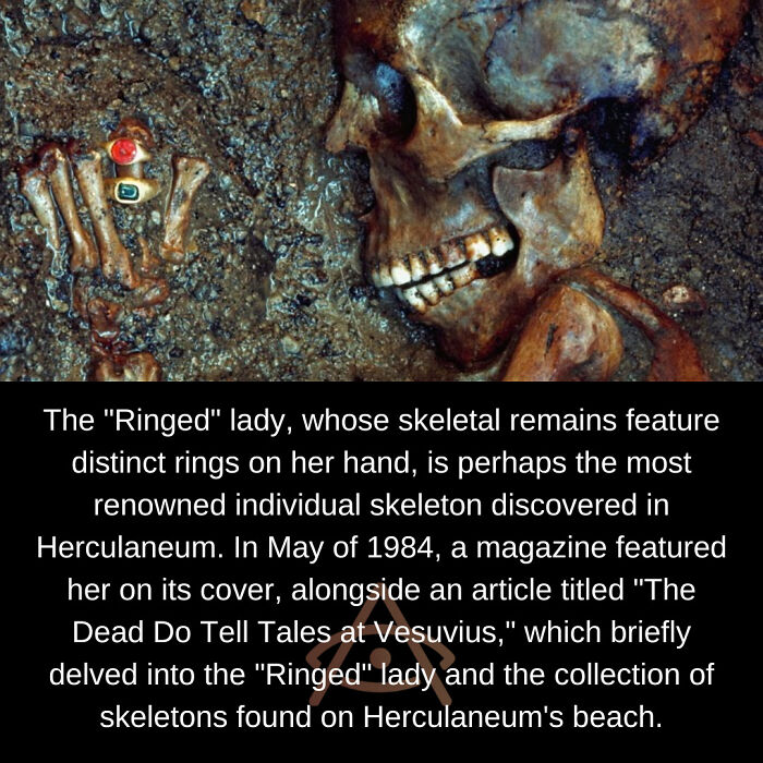 The "Ringed" Lady