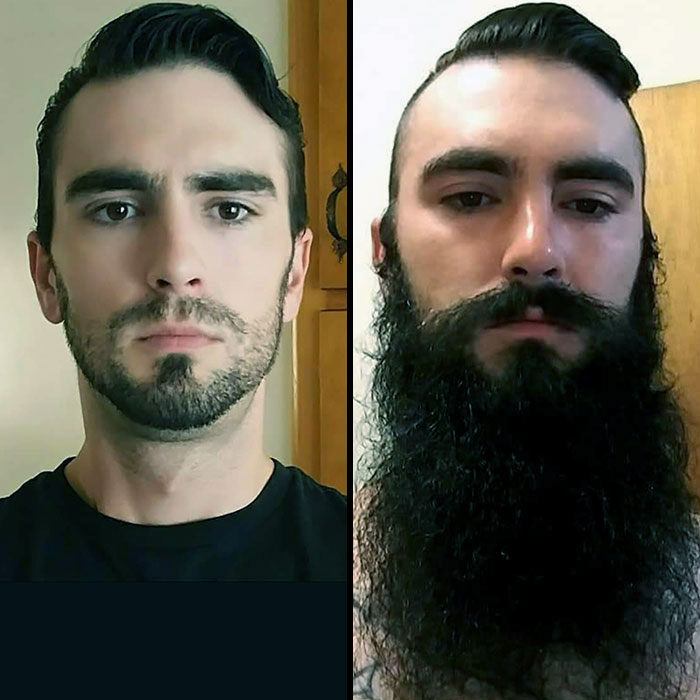 My Beard Advice: Let It Grow