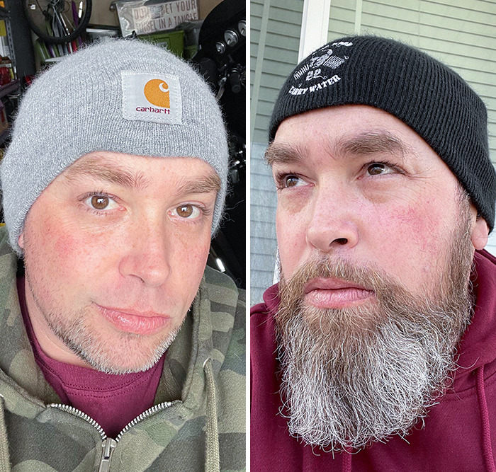 My Before And After. Beards Are Really A Makeup For Men