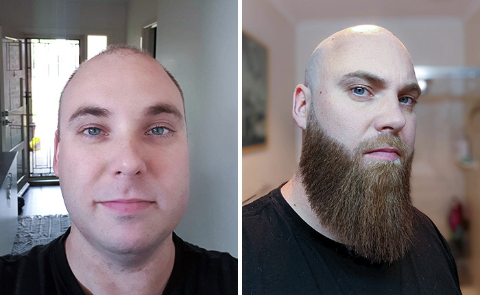Here's A Before And After Shot Of When I Didn't Have A Beard To Now
