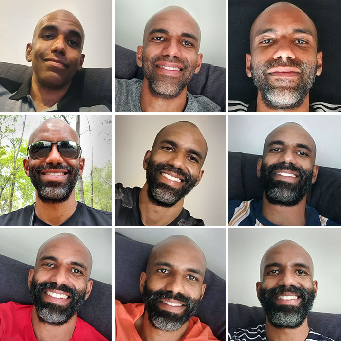 Evolución de la barba. 8 semanas después del afeitado