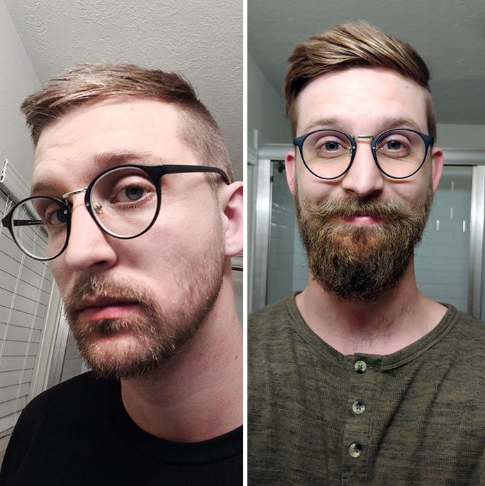 This Is The Difference Between Weeks And Months. If You Want To Know If You Should Keep It Or Shave It, Then Let It Grow And Keep It Neat