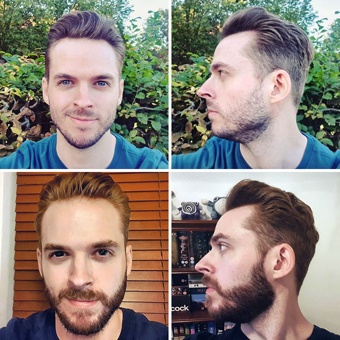 To Beard, Or Not To Beard? That Is The Question