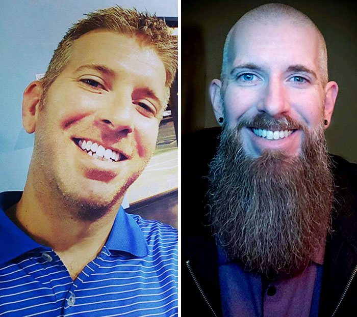 My Face Before And After I Grew A Beard