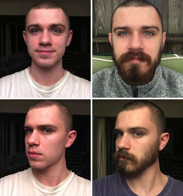 I Was So Close To Getting Accurate Before And After Photos. 3 Months In