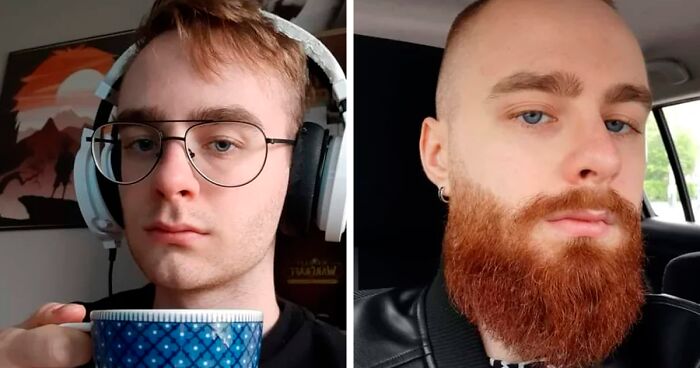 “Puberty Hit You Like A Truck”: These 50 Pics Of Men Before And After Beards May Show Just What You’ve Been Missing In Your Life (New Pics)