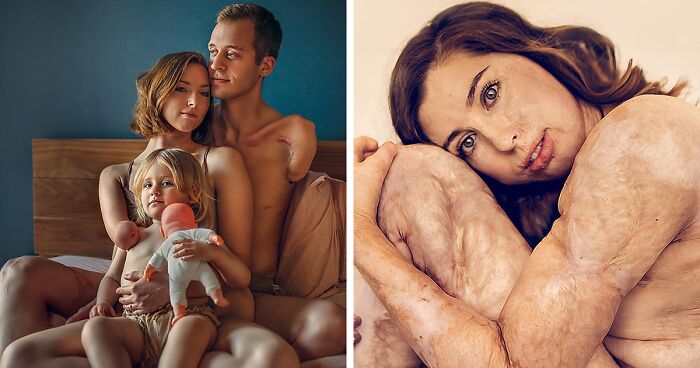 “Changing the Conversation”: 12 Raw Stories Behind These People’s Unique Appearances Captured In A Photography Project By Sujata Setia