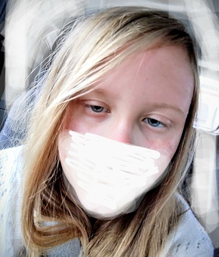 Me!!! (With My Sunburnt Face)