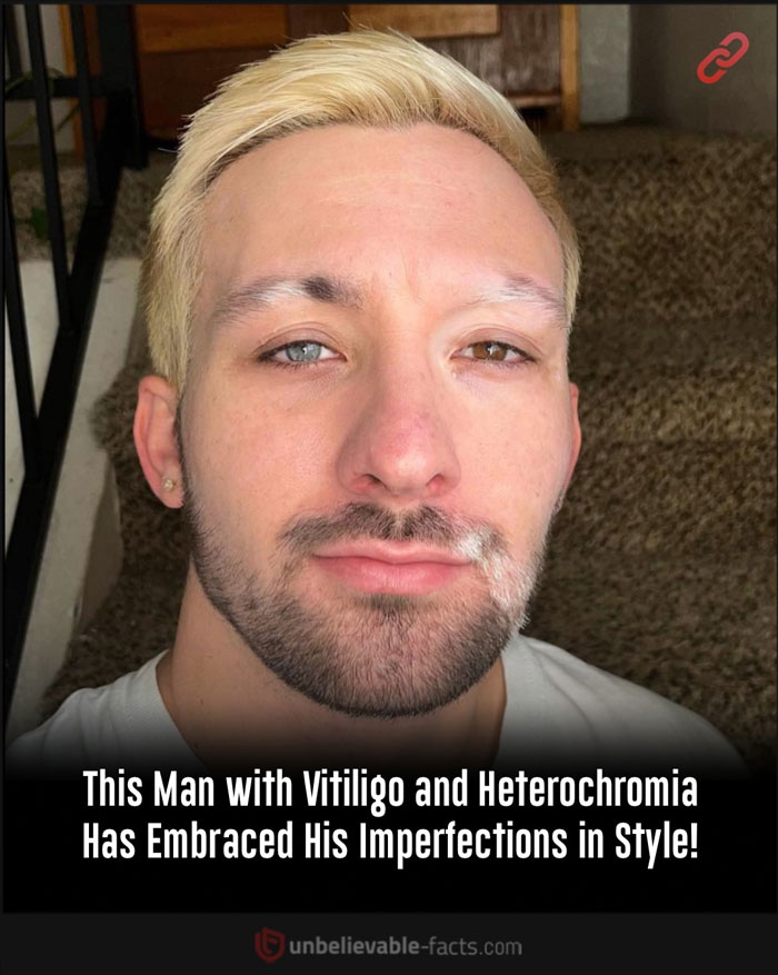 Page-Shares-Unbelievable-Facts