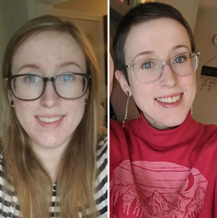 My Appearance While Unknowingly Living With HIV For 5 Years vs. 2 Years With Treatment