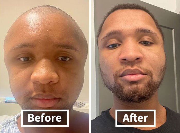 50 Interesting And Surprising Comparison Images That Help Make Sense Of The Things Around Us (New Pics)