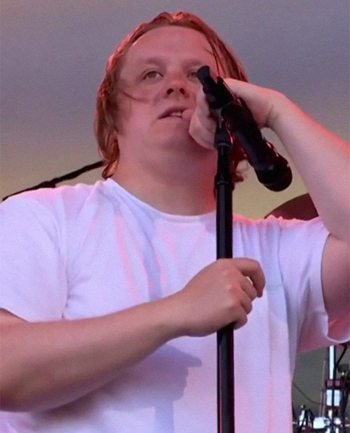 Lewis Capaldi Apologizes To Fans As He Battles Tics During The Show, And The Crowd’s Response Is Amazing Lewis Capaldi Apologizes To Fans As He Battles Tics During The Show, And The Crowd’s Response Is Amazing