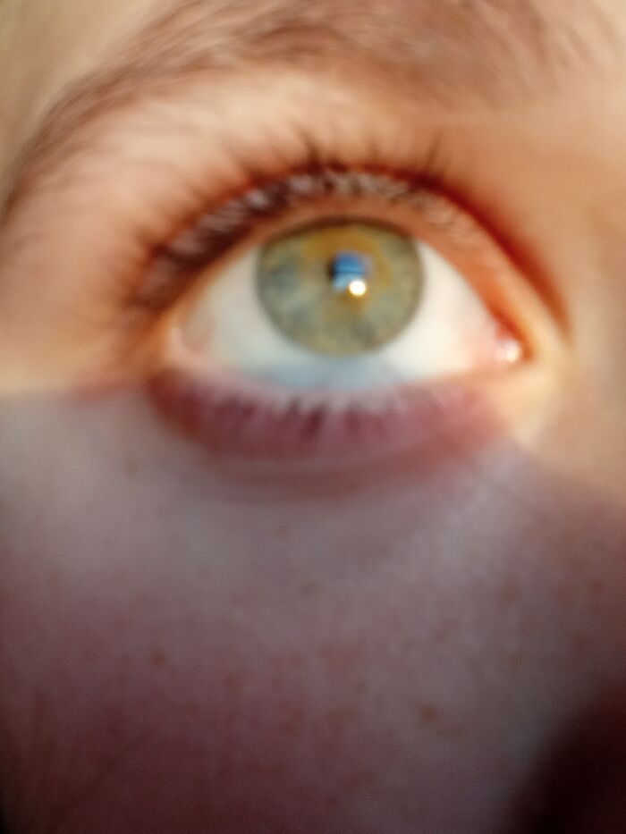 A Random Photo Of My Eye In The Sunlight 😂