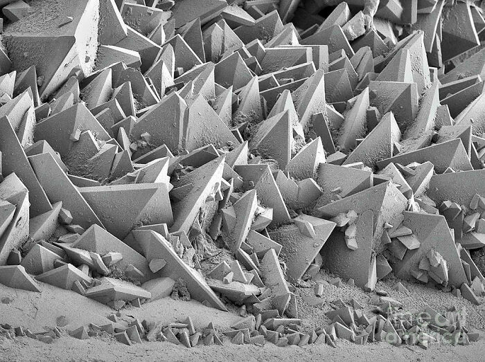 Kidney Stone Surface As Seen In An Electron Microscope