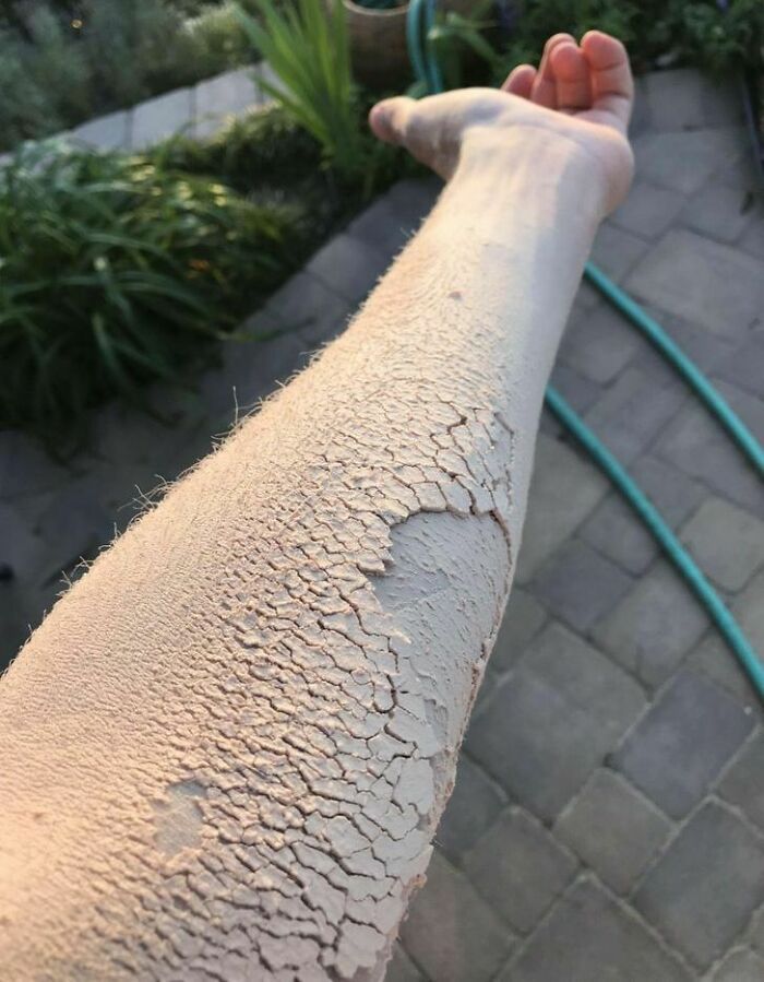 Arm Caked With Wood Dust, But Looks Disturbing