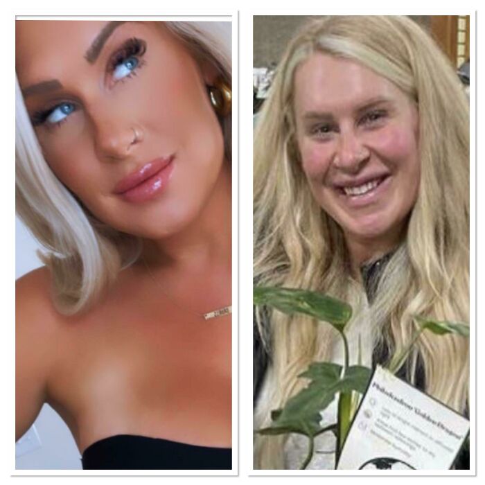 Mlm Hun Wants You To Believe Her Transformation Is From “Collagen” As She Hawks Amazon For Pennies