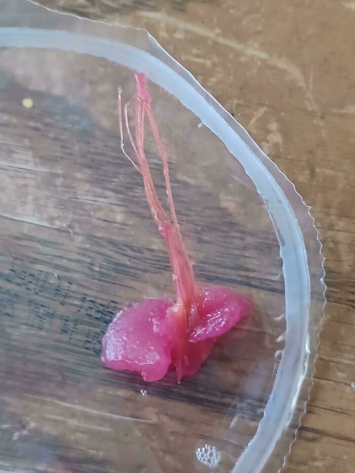 These Spindly, Brittle Root Like Things On This Piece Of Fruit From My Fruit Cup This Morning