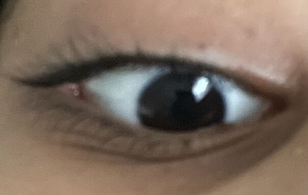 Ignore My Dark Circles 😭