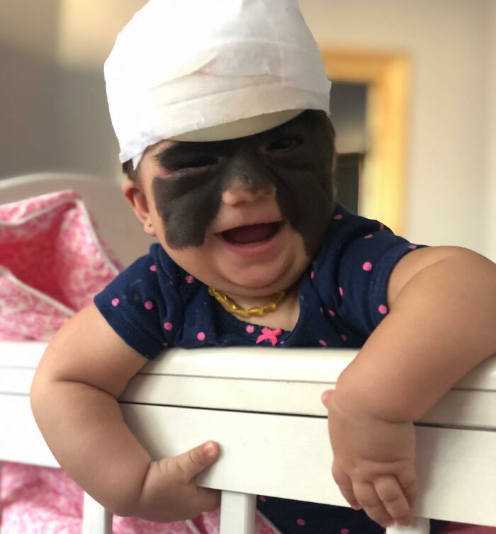 This 4-Year-Old Girl Has Undergone Multiple Surgeries To Get A Dangerous Birthmark Removed From Her Face