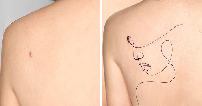 40 Personas que taparon sus cicatrices con tatuajes y quedó genial