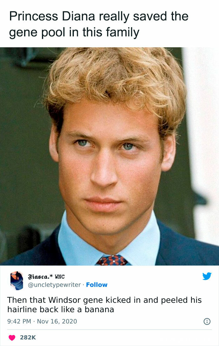 “Peeled His Hairline Back Like A Banana”