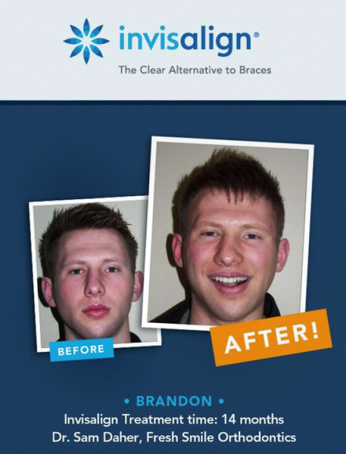 This Ad Is For Dental Care. It Fails To Show The Teeth In The Before Picture