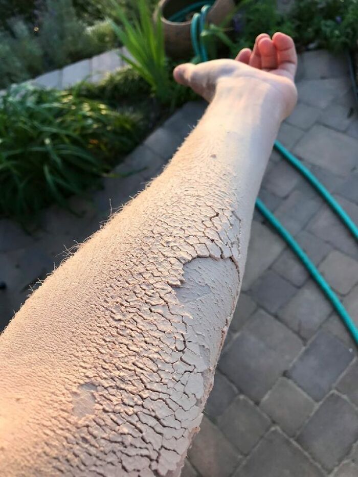 This Wood Dust Makes My Arm Look Like Dry, Cracked Dirt