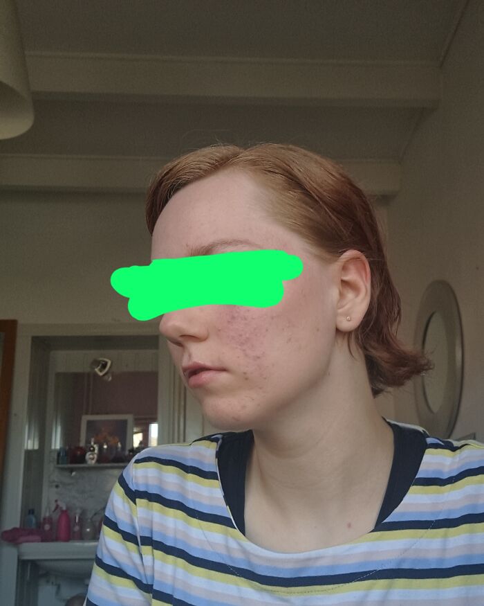 Currently Growing Out My Natural Hair