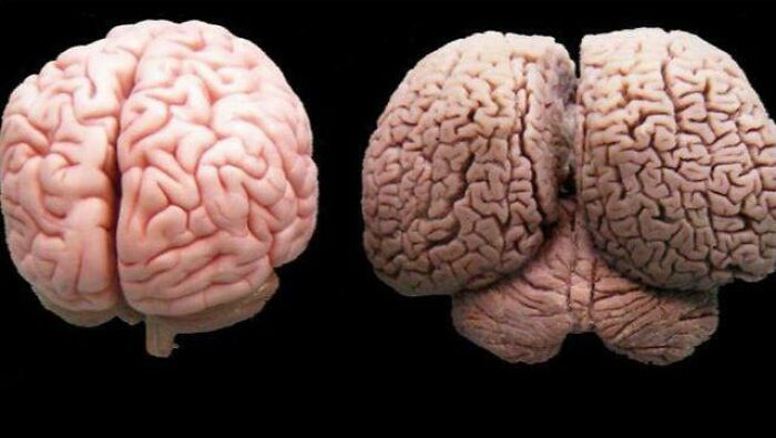 🔥 Human Brain vs. Dolphin Brain. Dolphins Only Ever Sleep With One Hemisphere At A Time - The Other Half Remains Awake, Alert For Danger And Managing Their Surfacing