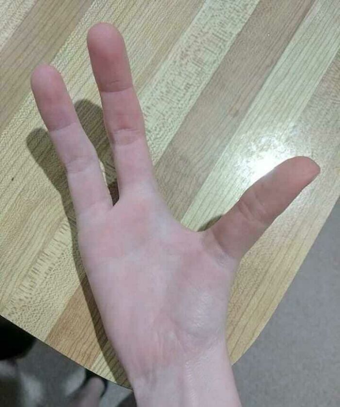 Modified hand reflecting personal transformation in unique setting. Modified hand reflecting personal transformation in unique setting.