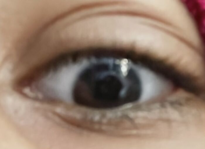 My Ugly Ass Eye 💀