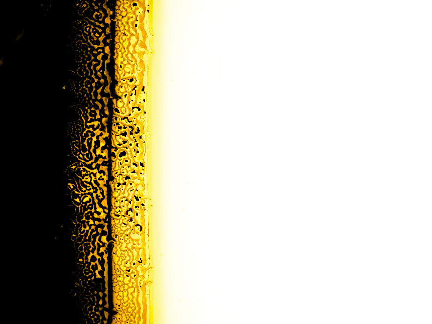 Nigrosin Remain On Microscope Slide III