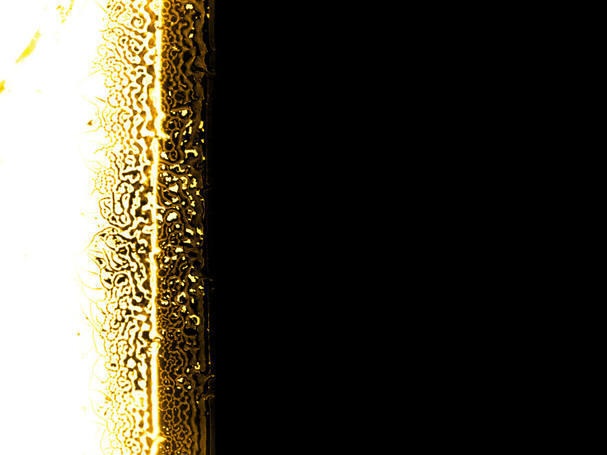 Nigrosin Remain On Microscope Slide II