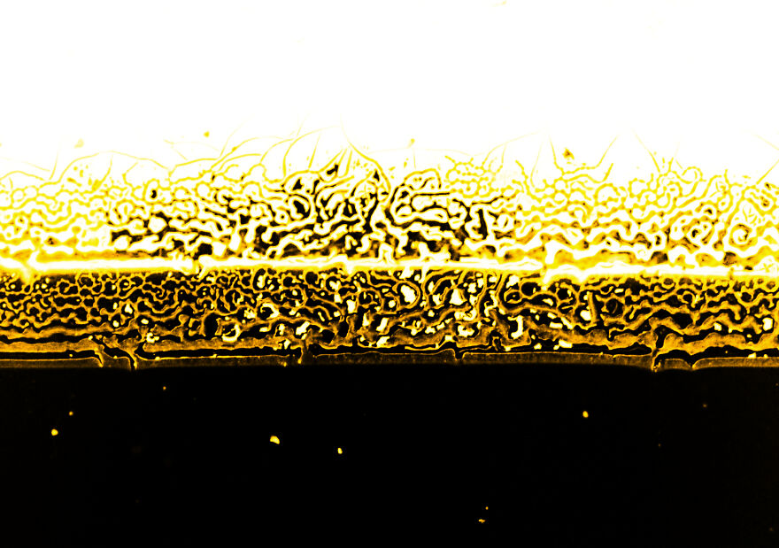 Nigrosin Remain On Microscope Slide