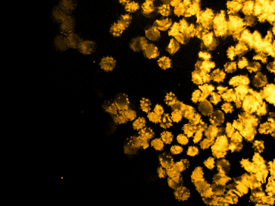 Blood Cells & Platelets II