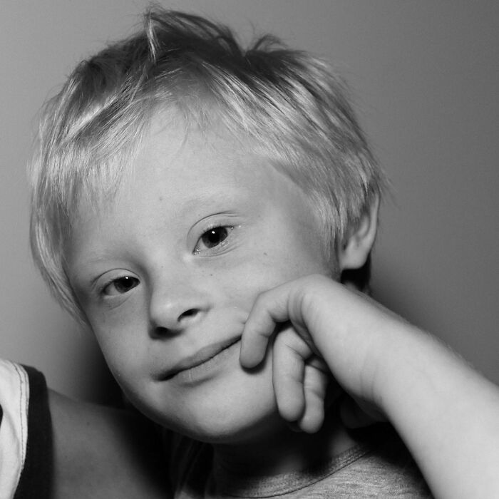 Andrew (6 Years Old) Mother Yulia (37 Years Old), Diagnosis: Down Syndrome