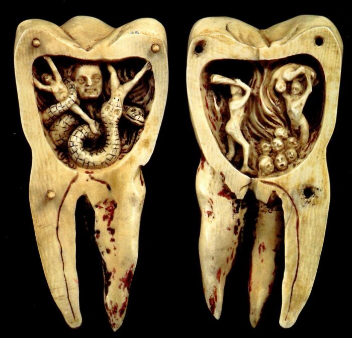The Tooth Worm As Hell’s Demon’, 18th Century Depiction Of The Tooth Worm Believed By Many In The Past To Bore Holes In Teeth And Cause Toothaches