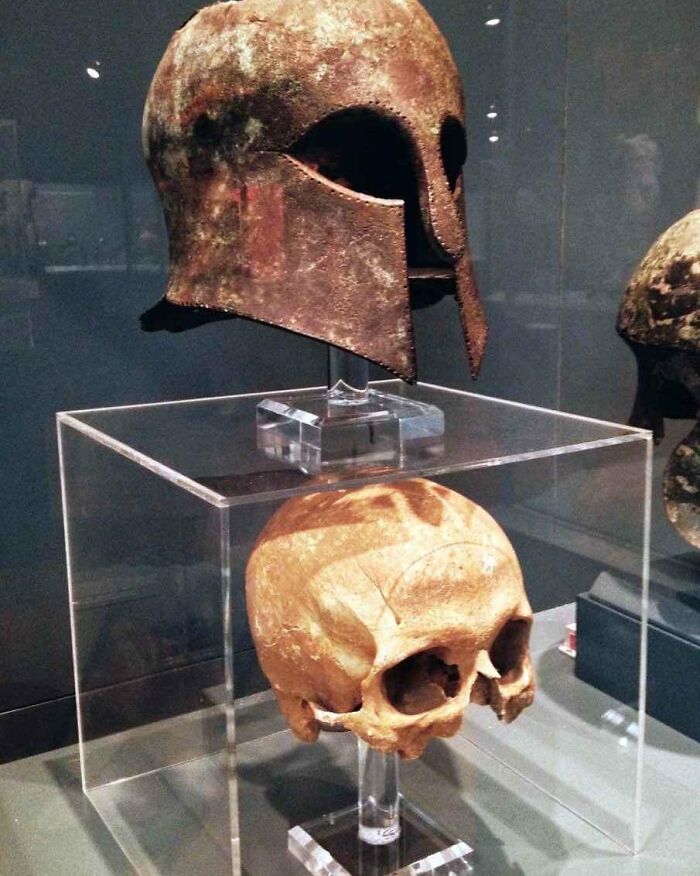 Corinthian Helmet From The Battle Of Marathon (490 Bc) Found With The Warrior's Skull Inside