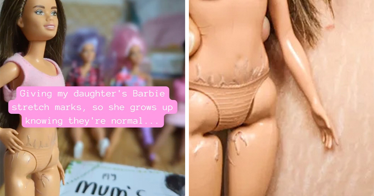 Mom Draws Stretch Marks On Daughter's Barbie - Vimarsana News