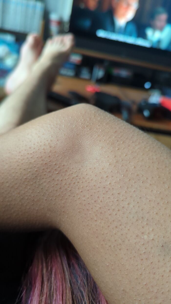 This Specific Spot On My Girlfriend's Elbow Doesnt Get Goosebumps
