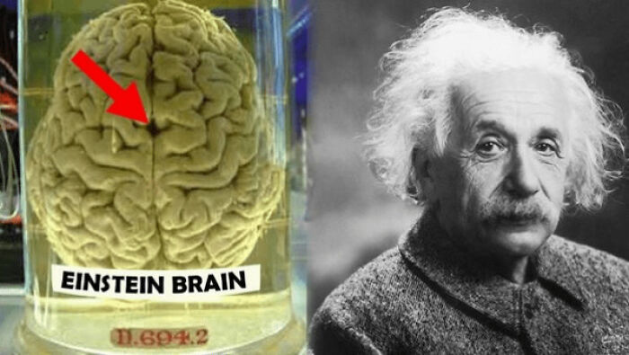 Albert Einstein's Brain Has Been Studied Extensively By Scientists Since It Was Removed From His Body After His Death In 1955