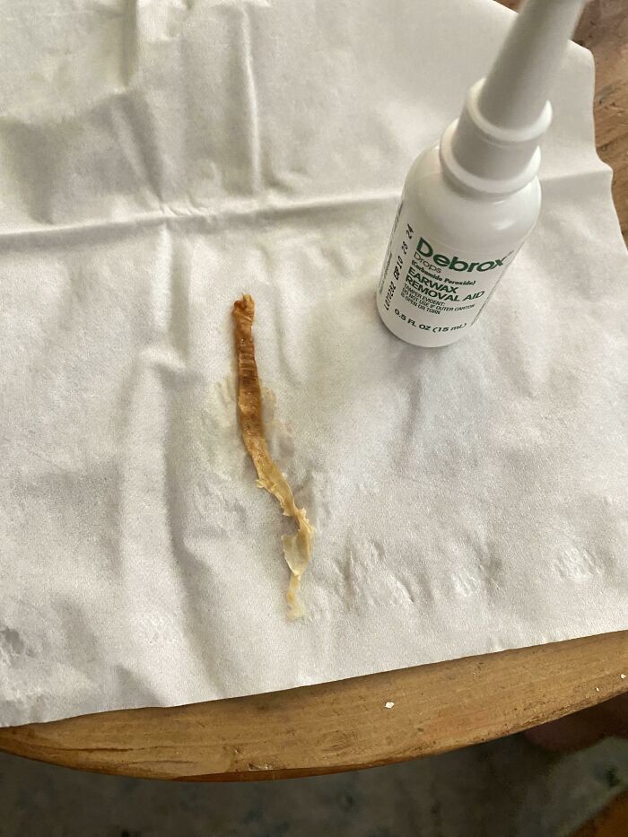 This Thing That Came Out Of My Husbands Ear