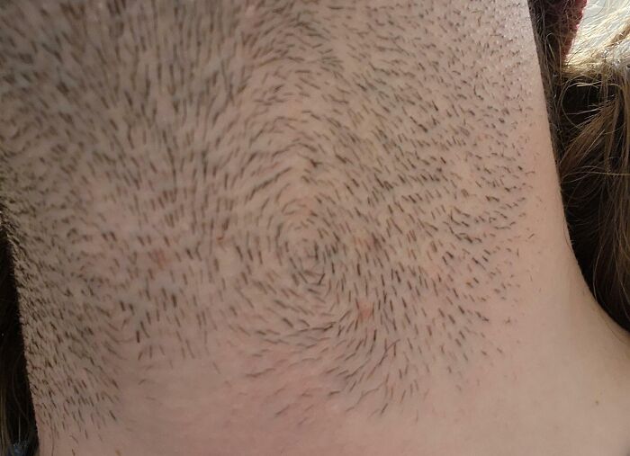 I Have A 360° Swirl In My Beard That Makes It Almost Impossible To Get A Perfect Shave