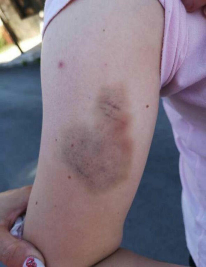 “Absolute Disgrace”: Woman Fined For Being Too Brutal On Her Attacker