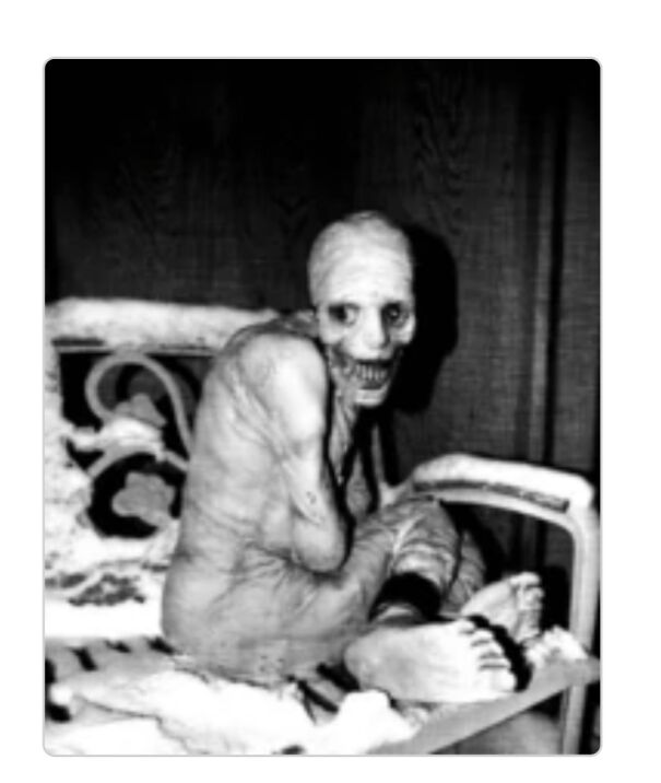 Perhaps This Image From The " Russian Sleep Experiment?"
